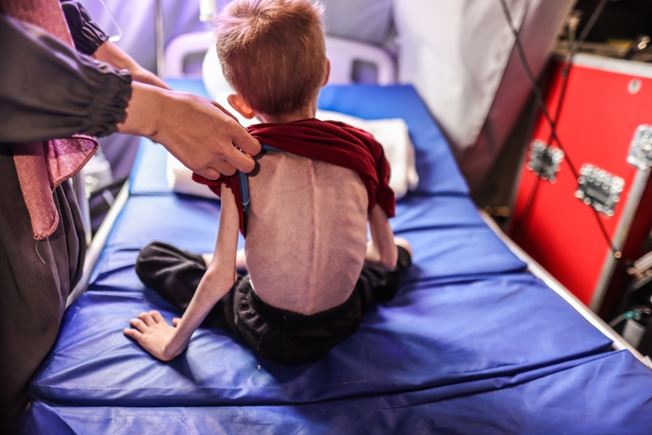 ف. (6 أعوام)، الذي لديه سوء تغذية، يتلقى العلاج بعد إجلائه من شمال قطاع غزة إلى المستشفى الميداني التابع لـ "الهيئة الطبية الدولية"، 24 مارس/آذار 2024. 