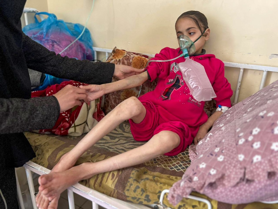 ن. (11 عاما)، تتلقى علاجا لسوء التغذية والجفاف الحاد في مستشفى كمال عدوان في بيت لاهيا، غزة، 25 مارس/آذار 2024.